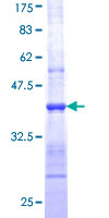 ab159005 on a 12.5% SDS-PAGE stained with Coomassie Blue.