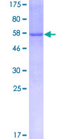 ab153235 on a 12.5% SDS-PAGE stained with Coomassie Blue.
