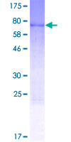 ab162199 on a 12.5% SDS-PAGE stained with Coomassie Blue.