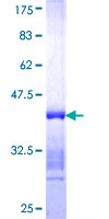 ab163813 on a 12.5% SDS-PAGE stained with Coomassie Blue.