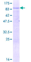 ab163972 on a 12.5% SDS-PAGE stained with Coomassie Blue.
