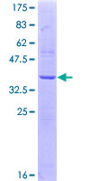 ab159028 on a 12.5% SDS-PAGE stained with Coomassie Blue.