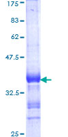 ab161799 on a 12.5% SDS-PAGE stained with Coomassie Blue.