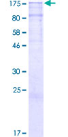 ab163499 on a 12.5% SDS-PAGE stained with Coomassie Blue.