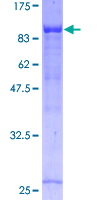 ab160158 on a 12.5% SDS-PAGE stained with Coomassie Blue.