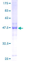 ab163920 on a 12.5% SDS-PAGE stained with Coomassie Blue.