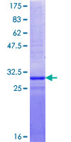 ab153400 on a 12.5% SDS-PAGE stained with Coomassie Blue.