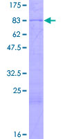 ab162606 on a 12.5% SDS-PAGE stained with Coomassie Blue.