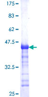 ab163641 on a 12.5% SDS-PAGE stained with Coomassie Blue.