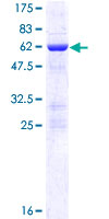 ab162403 on a 12.5% SDS-PAGE stained with Coomassie Blue.