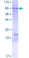ab165078 on a 12.5% SDS-PAGE stained with Coomassie Blue.