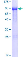 ab161166 on a 12.5% SDS-PAGE stained with Coomassie Blue.