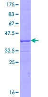 ab160527 on a 12.5% SDS-PAGE stained with Coomassie Blue.