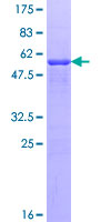 ab160962 on a 12.5% SDS-PAGE stained with Coomassie Blue.