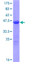 ab160960 on a 12.5% SDS-PAGE stained with Coomassie Blue.