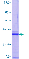 ab160961 on a 12.5% SDS-PAGE stained with Coomassie Blue.