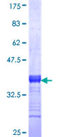 ab153648 on a 12.5% SDS-PAGE stained with Coomassie Blue.