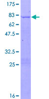ab159680 on a 12.5% SDS-PAGE stained with Coomassie Blue.