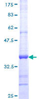 ab159681 on a 12.5% SDS-PAGE stained with Coomassie Blue.
