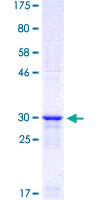 ab159682 on a 12.5% SDS-PAGE stained with Coomassie Blue.