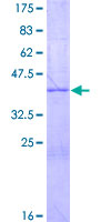 ab165203 on a 12.5% SDS-PAGE stained with Coomassie Blue.