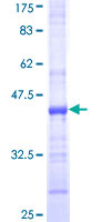ab162361 on a 12.5% SDS-PAGE stained with Coomassie Blue.