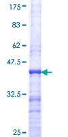 ab161840 on a 12.5% SDS-PAGE stained with Coomassie Blue.