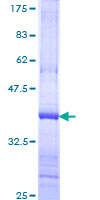 ab160028 on a 12.5% SDS-PAGE stained with Coomassie Blue.