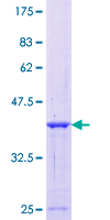 ab153401 on a 12.5% SDS-PAGE stained with Coomassie Blue.