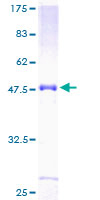ab166418 on a 12.5% SDS-PAGE stained with Coomassie Blue.