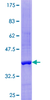 ab162324 on a 12.5% SDS-PAGE stained with Coomassie Blue.