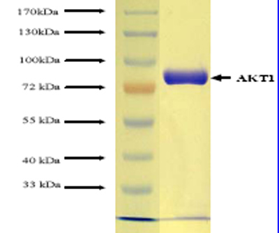 ab62279 on SDS-PAGE. Band at ~85kDa.