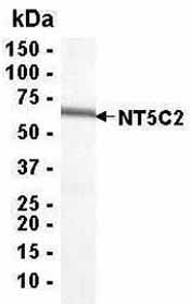 SDS-PAGE analysis of NT5C2 recombinant protein. 4-20% SDS gradient gel. Coomassie blue staining. Observed band size 65kDa.