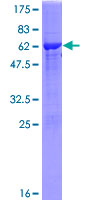 ab165200 on a 12.5% SDS-PAGE stained with Coomassie Blue.