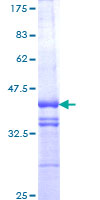 12.5% SDS-PAGE analysis of ab152570 stained with Coomassie Blue.