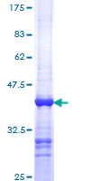ab158991 on a 12.5% SDS-PAGE stained with Coomassie Blue.