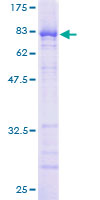 ab161728 on a 12.5% SDS-PAGE stained with Coomassie Blue.