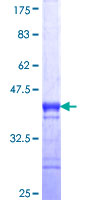ab161729 on a 12.5% SDS-PAGE stained with Coomassie Blue.