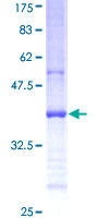 ab162264 on a 12.5% SDS-PAGE stained with Coomassie Blue.