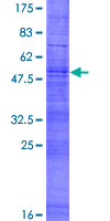 ab161973 on a 12.5% SDS-PAGE stained with Coomassie Blue.