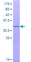 ab161976 on a 12.5% SDS-PAGE stained with Coomassie Blue.