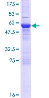 ab164228 on a 12.5% SDS-PAGE stained with Coomassie Blue.