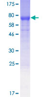 ab164712 on a 12.5% SDS-PAGE stained with Coomassie Blue.