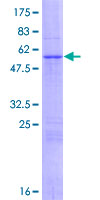 ab161846 on a 12.5% SDS-PAGE stained with Coomassie Blue.