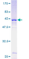 ab161331 on a 12.5% SDS-PAGE stained with Coomassie Blue.