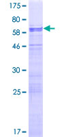 ab162037 on a 12.5% SDS-PAGE stained with Coomassie Blue.