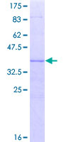 ab153032 on a 12.5% SDS-PAGE stained with Coomassie Blue.