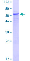 ab163958 on a 12.5% SDS-PAGE stained with Coomassie Blue.