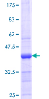 ab166339 on a 12.5% SDS-PAGE stained with Coomassie Blue.