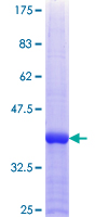 ab161143 on a 12.5% SDS-PAGE stained with Coomassie Blue.